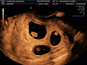 Babies Gamma, Delta & Epsilon