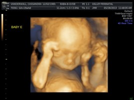 Baby E has got her dukes up!