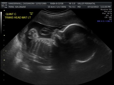 Baby C's Profile